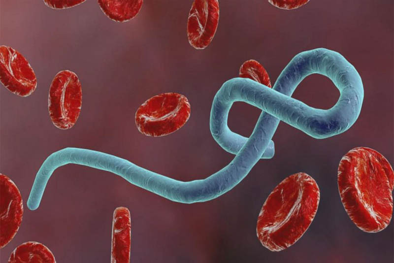 ebola