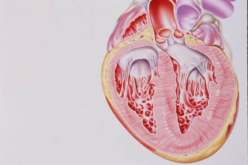 ischemic-heart-disease